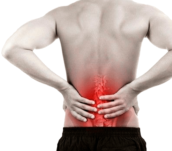 Міжхребцева грижа