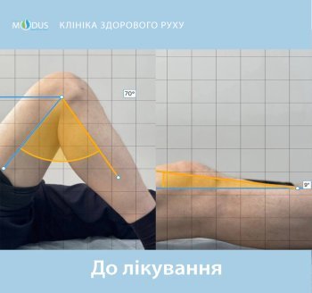 До