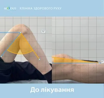 До