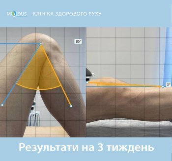 Після