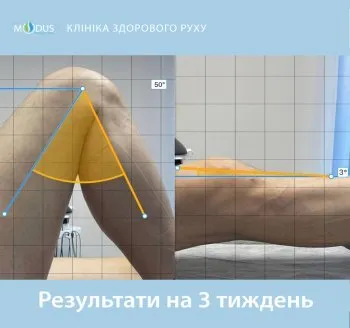 Після