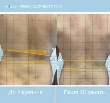 До
