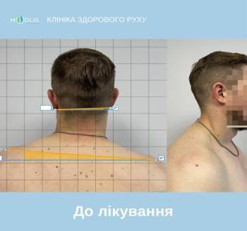 До