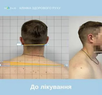 До