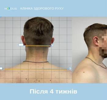 Після