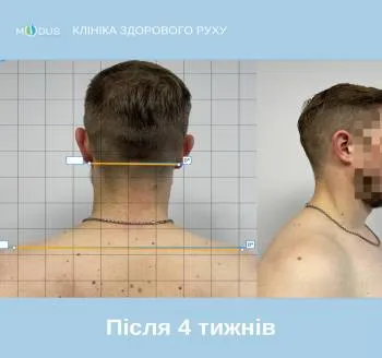 Після