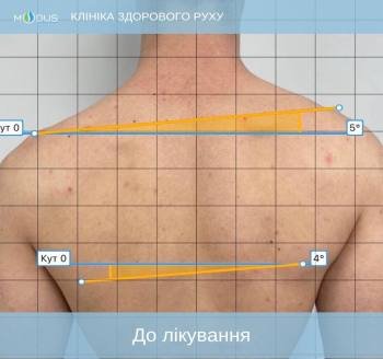До