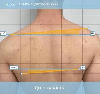 До