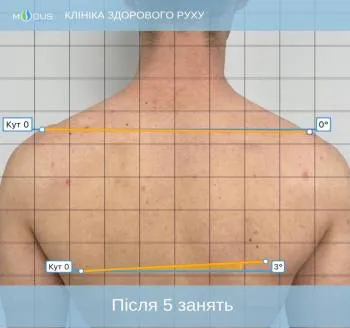 Після