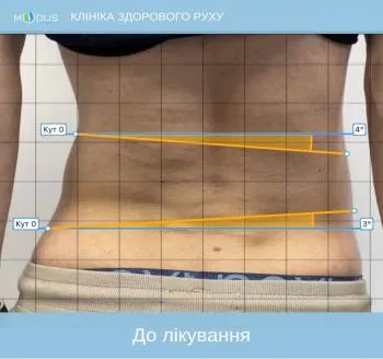 До
