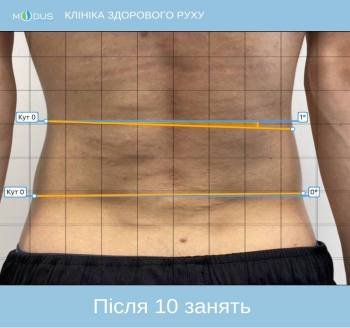 Після
