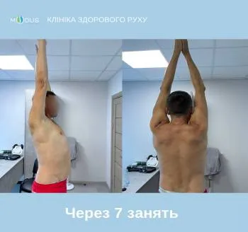 Після